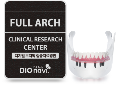 디지털 full arch