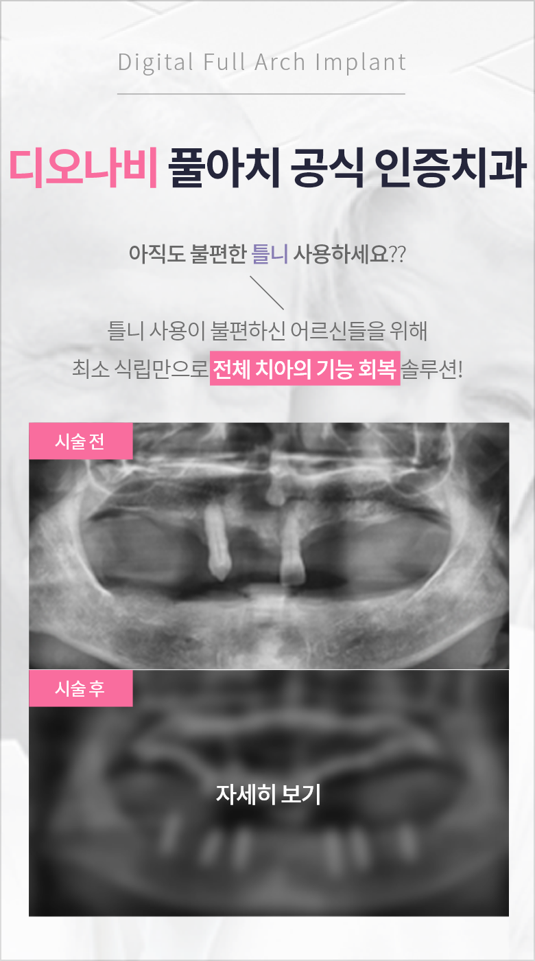 디오나비 풀아치 공식 인증치과