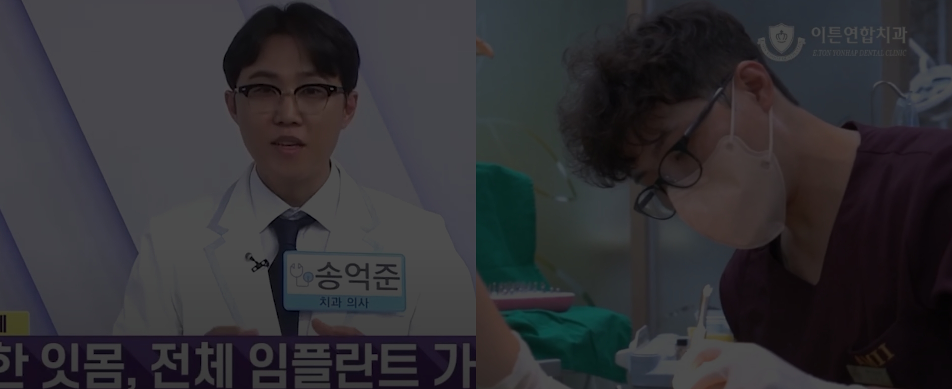 최소식립 최대효과 풀아치 임플란트